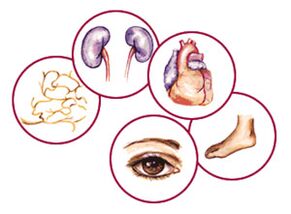 Organele la care complicații ale diabetului zaharat
